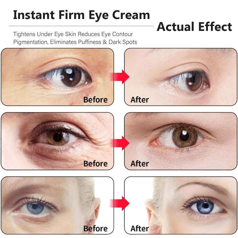 eye tightening cream