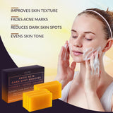 Kojic Acid Dark Spot Remover Soap Bars